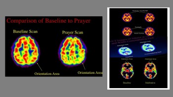 Comparison of the Effect of Religious Meditation on the Brain